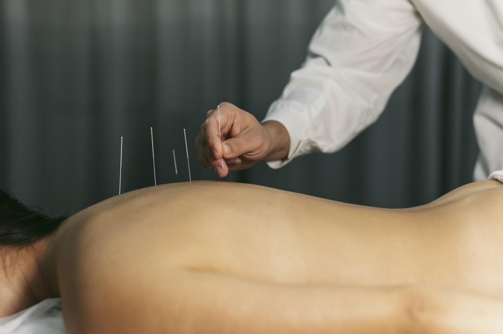 Acupuncturist in oldenzaal
