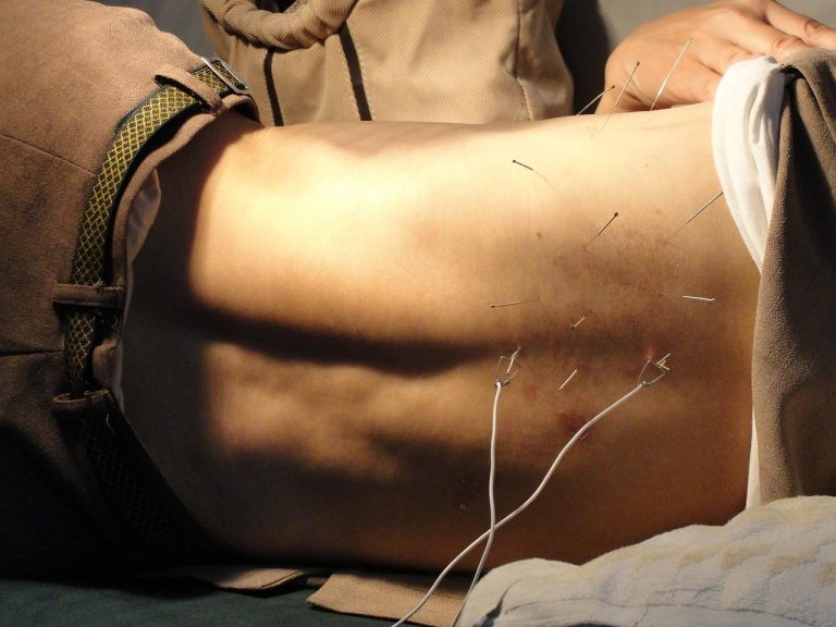 Acupuncturist in oldenzaal